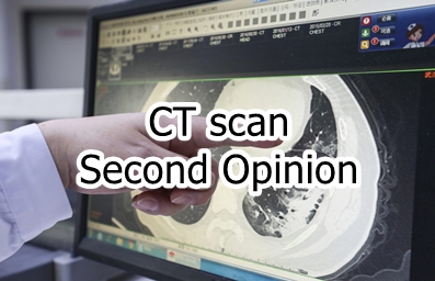 CT SCan Second Opinion